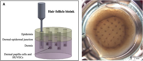实验室培育皮肤上首次3D打印毛囊